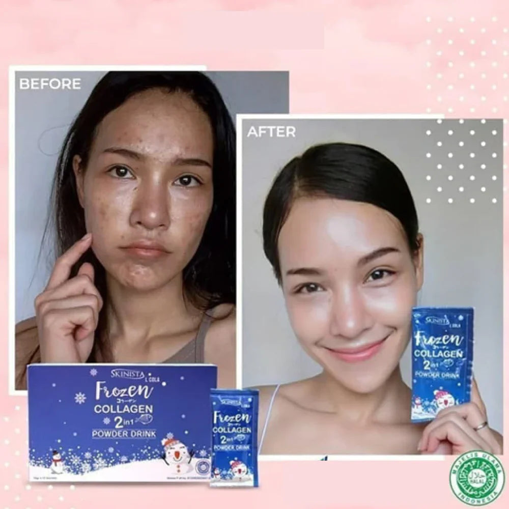 Gluta Capsules for Whitening – Gluta Frozen Collagen 2 in 1