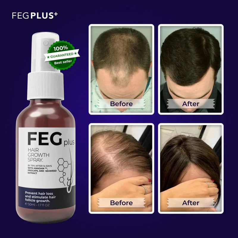 FEG Plus Hair Growth Spray For Stronger, Thicker & Healthier Hair