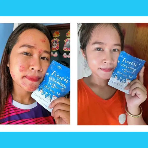 Gluta Capsules for Whitening – Gluta Frozen Collagen 2 in 1